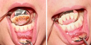 Oral Pathology